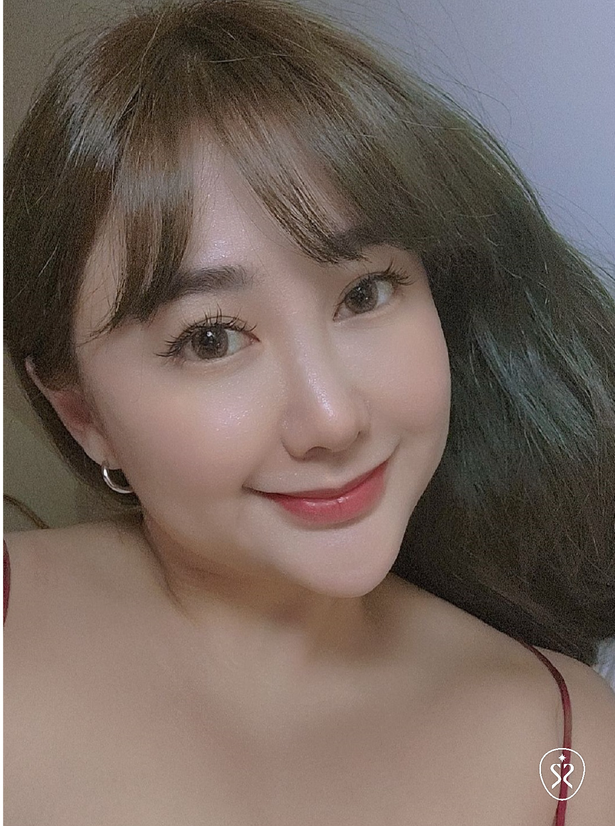 喬雅登玻尿酸豐唇療程成果分享